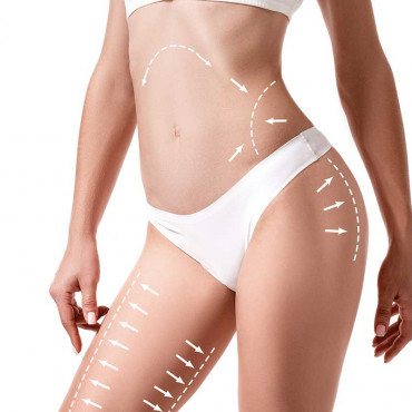 Liposuction em Corsicana / TX