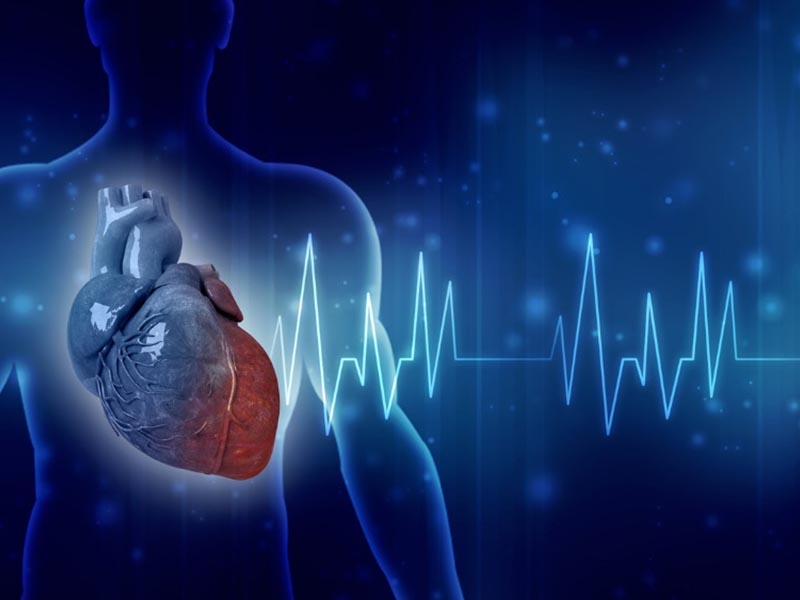 Electrocardiogram