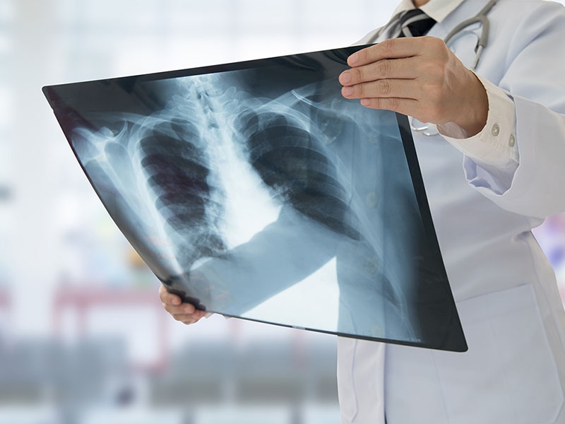 X-ray