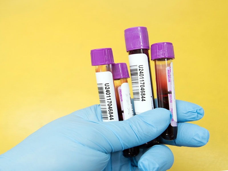 Blood test